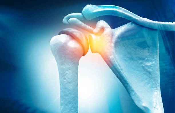 Arthroscopic Shoulder Rotator Cuff Repair