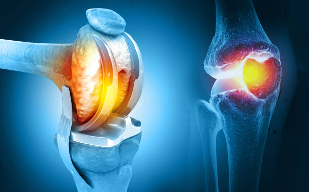 Joint Replacement Surgeon